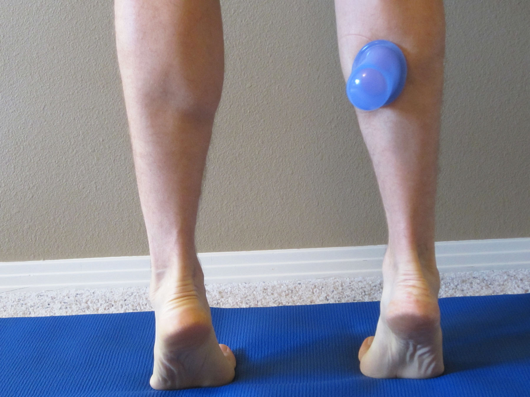 Cupping, Should Runners Try it Too? Marathon Training Academy